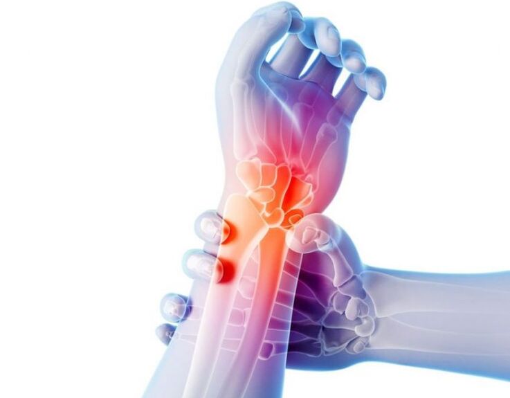 L'arthrose des articulations s'accompagne de douleurs et nécessite un traitement complexe