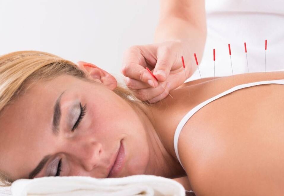 L'acupuncture aide à soulager la douleur liée à l'ostéochondrose